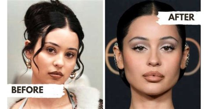 Alexa Demie before and after surgery