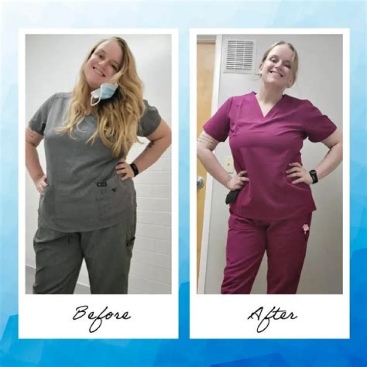 Alison Pill Weight Loss: Before And After Photo