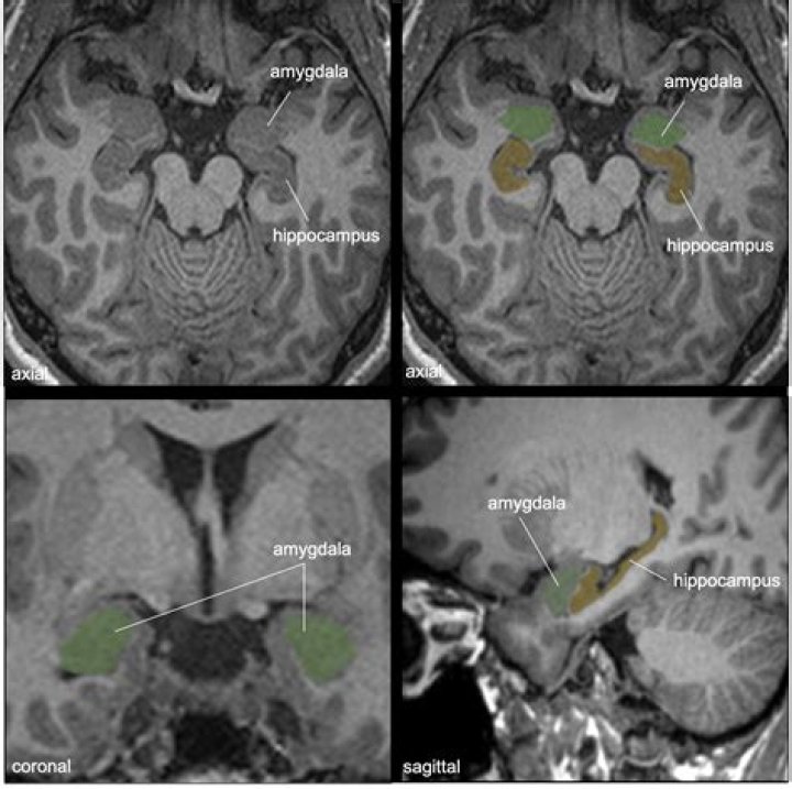Artist 101: Hippo Campus - CelebMix