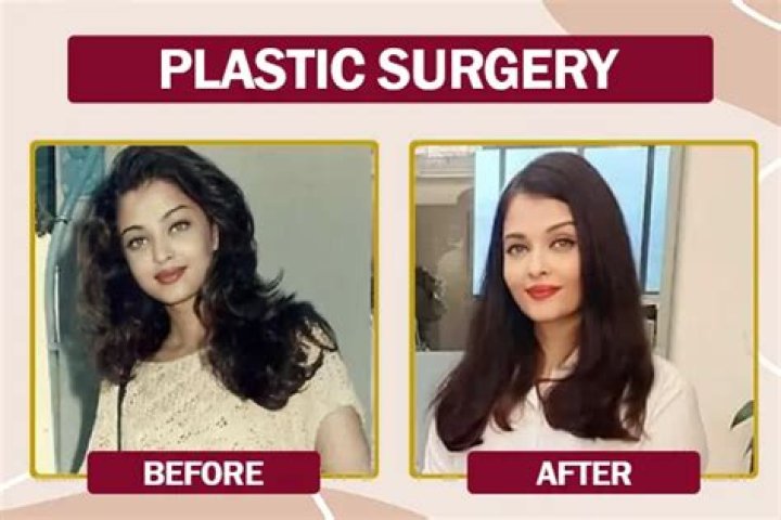 Did MS Sethi Get Plastic Surgery? Check Details Here