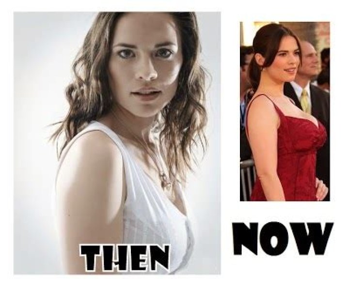 Hayley Atwell Plastic Surgery Before and After