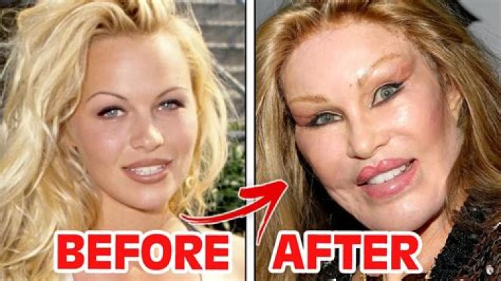 I Regret Getting A Plastic Surgery – Popular Celebrity Laments