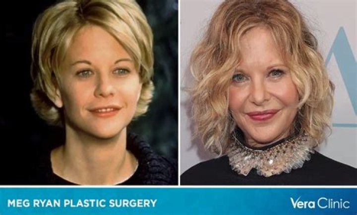 Jeri Ryan Plastic Surgery Before and After