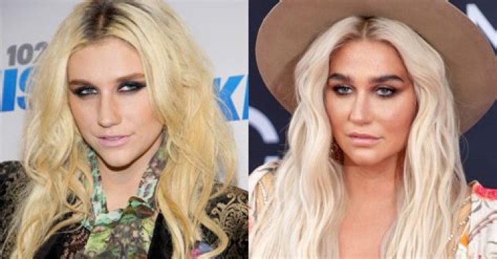 Kesha Fans Fight Back: #FreedomForKesha