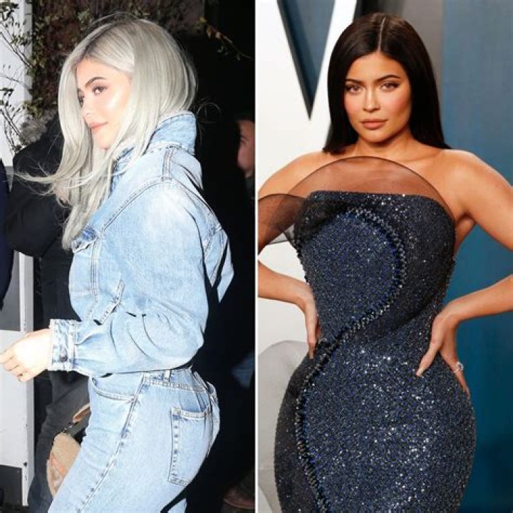 Kylie Jenner’s Body Before And After Implants (PHOTOS)