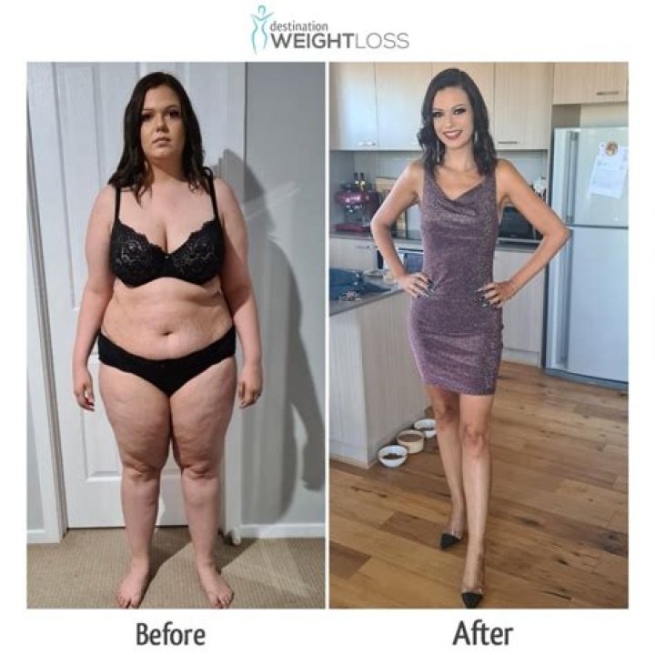 Miranda Lambert Denies Gastric Bypass Surgery Claims For Weight Loss (PHOTO)