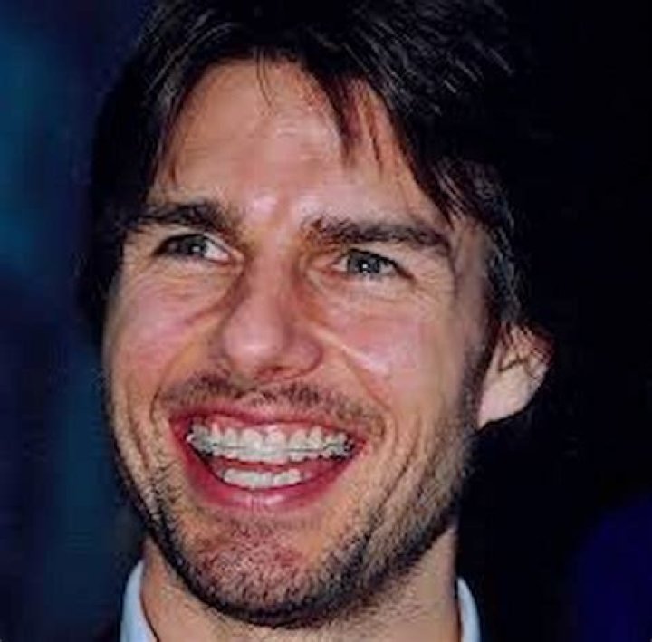 Strangest Things About Tom Cruise’s Teeth And Smile