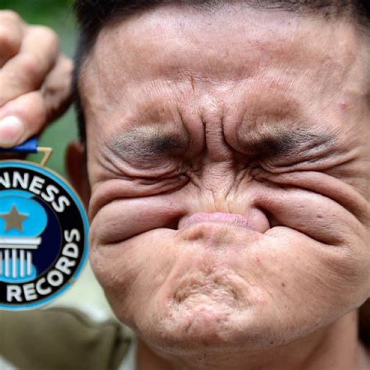 Ugliest People 2023 - Who Is Ugliest Person In The World