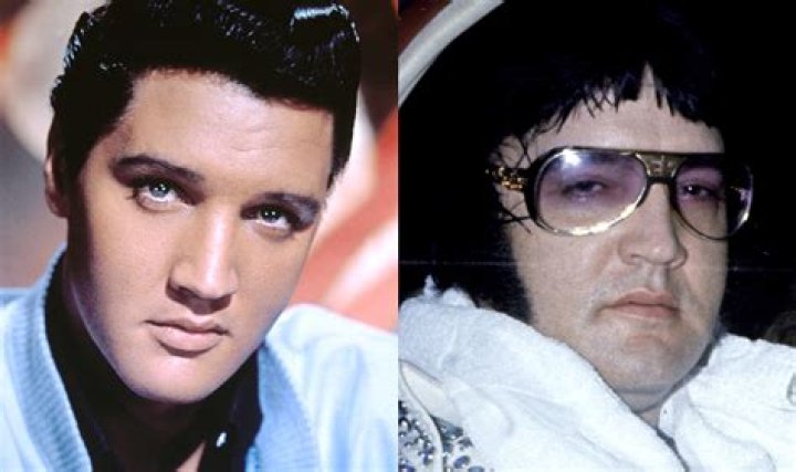 What happened to Elvis Presley: How did he die?
